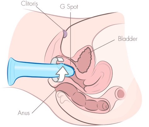 Diagrama mostrando o dildo tipo 