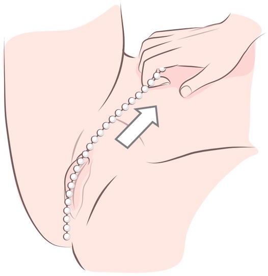 Ilustração mostrando o colar de contas sendo puxado entre as pernas ao longo da vulva