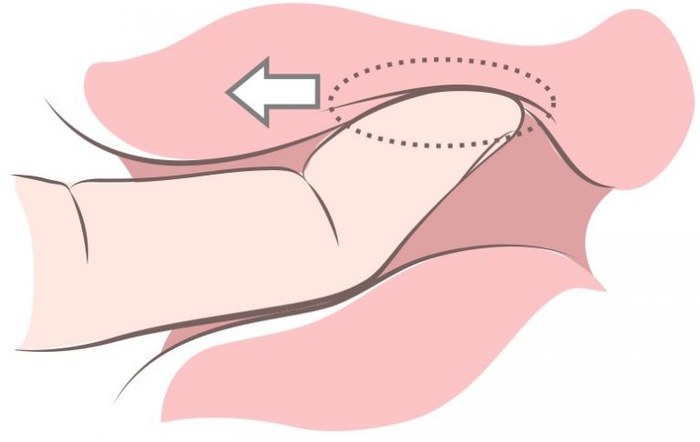 Ilustração do movimento de deslizar o dedo ao longo da parede vaginal