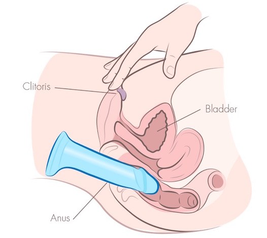 Diagrama mostrando a inserção anal de um brinquedo combinada com estimulação do clitóris