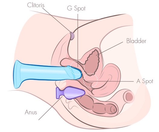 Diagrama mostrando um dildo inserido vaginalmente e um plug inserido analmente ao mesmo tempo